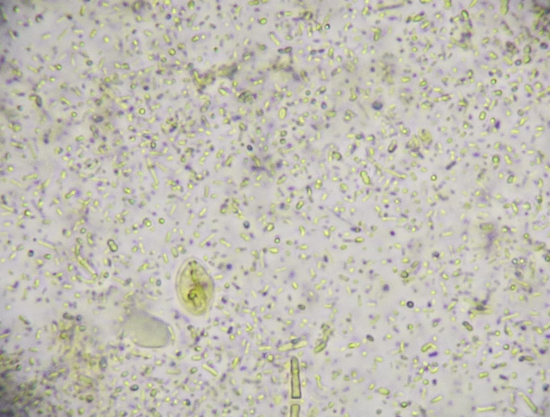 Giardia-Zysten im Kotpräparat von einem Hund mit Durchfall